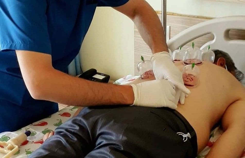 “Cupping” Warning From Experts: “Wrong Practices Cause Lifelong Pain”